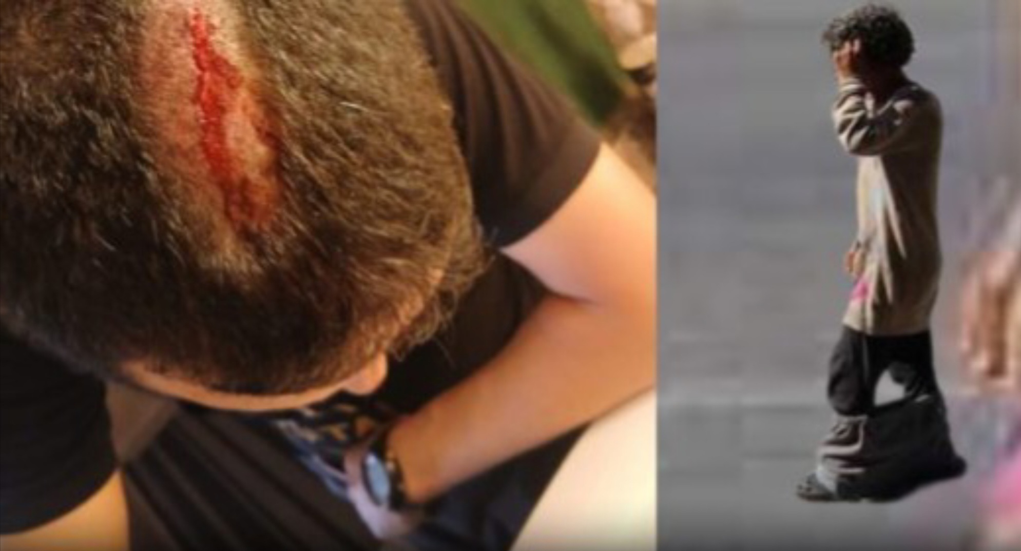 تنامي ظاهرة المختلين عقليا يثير القلق في عين حرودة بعد حادث اعتداء خطير!